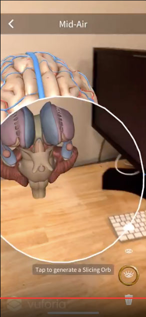 Medical app from the Yale School of Medicine showing a brain AR
